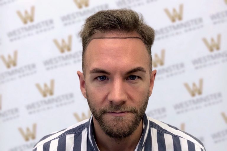 A man with signs of male pattern baldness and a beard, wearing a striped shirt, in front of a backdrop with a repeated logo pattern. He is looking directly at the camera with a neutral expression