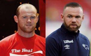 Split-image comparing a young man with red hair wearing a red soccer jersey on the left, and the same man older with a beard in a blue tracksuit on the right, showing evident signs of hair